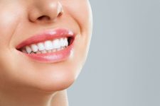 Remineralizing Your Teeth: What is It and How to Do It