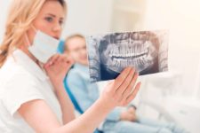 Why Do We Have Wisdom Teeth?