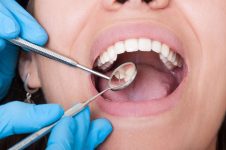 Do Cavities Cause Bad Breath?