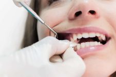 When to Stop Using Gauze After a Tooth Extraction