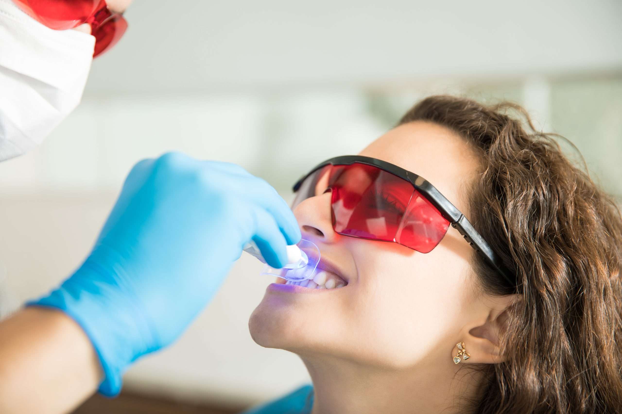 You are currently viewing Is Professional Teeth Whitening Worth It?